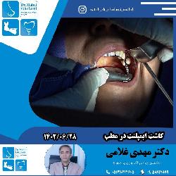 کاشت ايمپلنت در مطب دکتر مهدي غلامي در مشهد