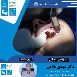 پنج واحد ايمپلنت همزمان در مطب دکتر مهدي غلامي در مشهد