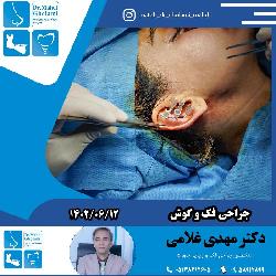جراحي فک و گوش دکتر مهدي غلامي در مشهد