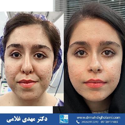جراحي فک در مشهد با دکتر مهدي غلامي