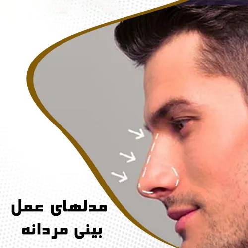 فرم‌هاي مختلف بيني مردانه