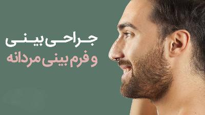 عمل بيني کلاسيک مردانه چيست و چه مزايايي دارد؟