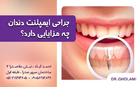 جراحي ايمپلنت دندان چه مزايايي دارد؟