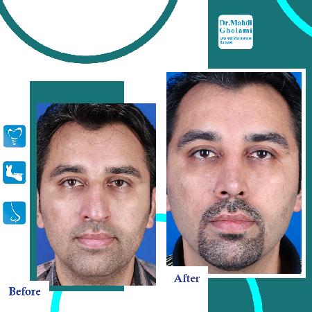 تصاویر قبل و بعد از عمل