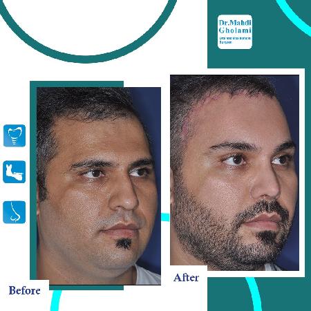 تصاوير قبل و بعد از عمل